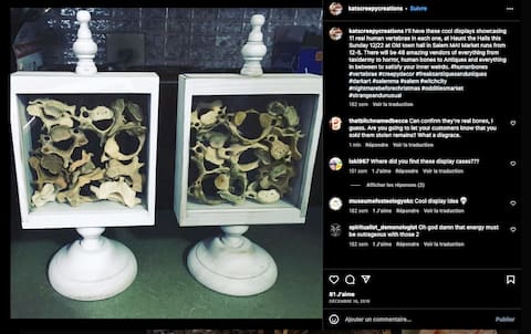 Katrina MacLean, worked alongside Harvard Medical School mortuary chief Cedric Lodge. In the capture, we see 11 human vertebrae that she displayed on Instagram.
