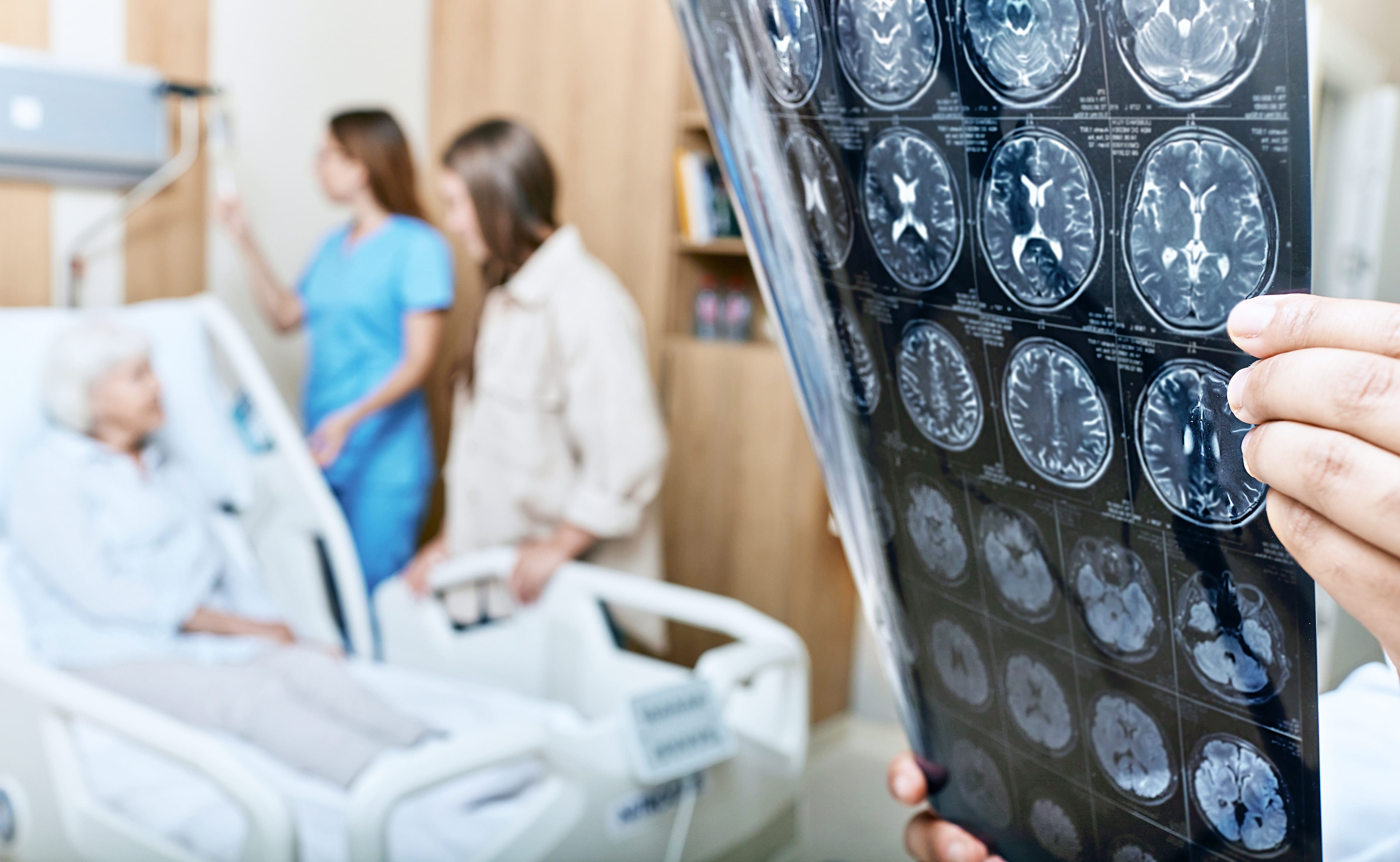 Tout ce que vous devez savoir &agrave; propos du donanemab: le nouveau m&eacute;dicament qui ralentit la maladie d'Alzheimer