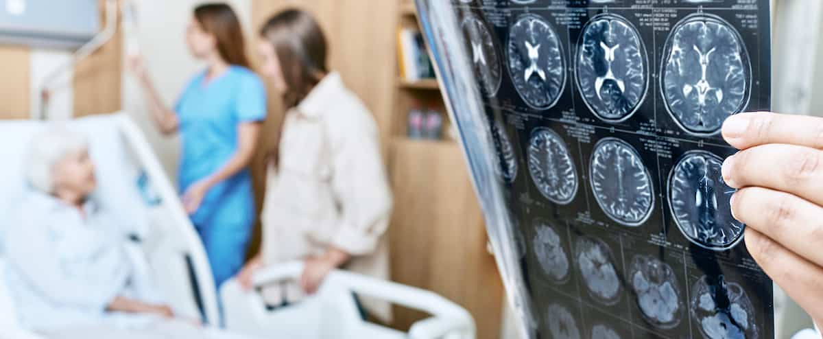 Tout ce que vous devez savoir à propos du donanemab: le nouveau médicament qui ralentit la maladie d'Alzheimer