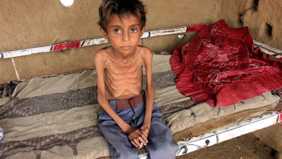Une Personne Meurt De Faim Toutes Les Quatre Secondes Dans Le Monde une-personne-meurt-de-faim-toutes-les-quatre-secondes-dans-le-monde