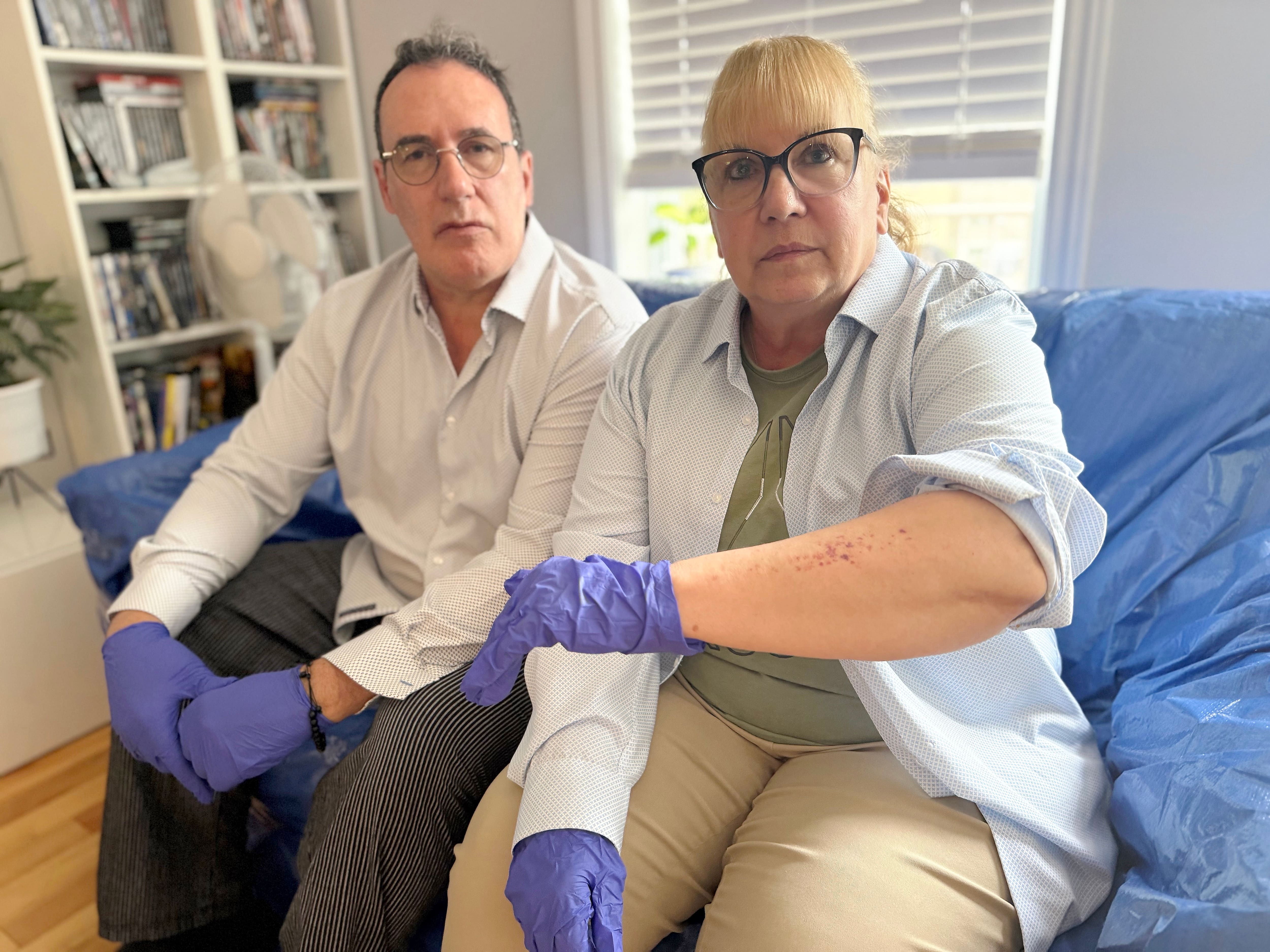 Gale croûteuse: un couple a dû voir quatre médecins avant d’avoir son diagnostic en plus de payer plus de 3000$ en traitements inutiles