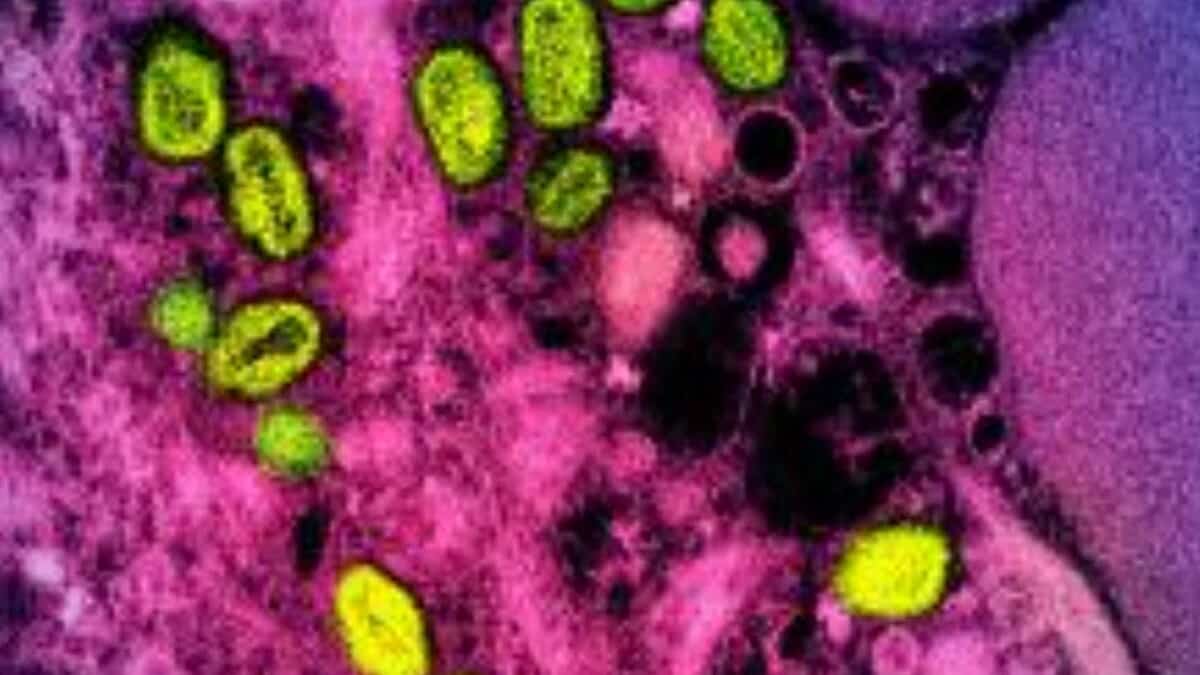 Monkeypox in Congo: 548 deaths since the beginning of the year Monkeypox in Congo: 548 deaths since the beginning of the year