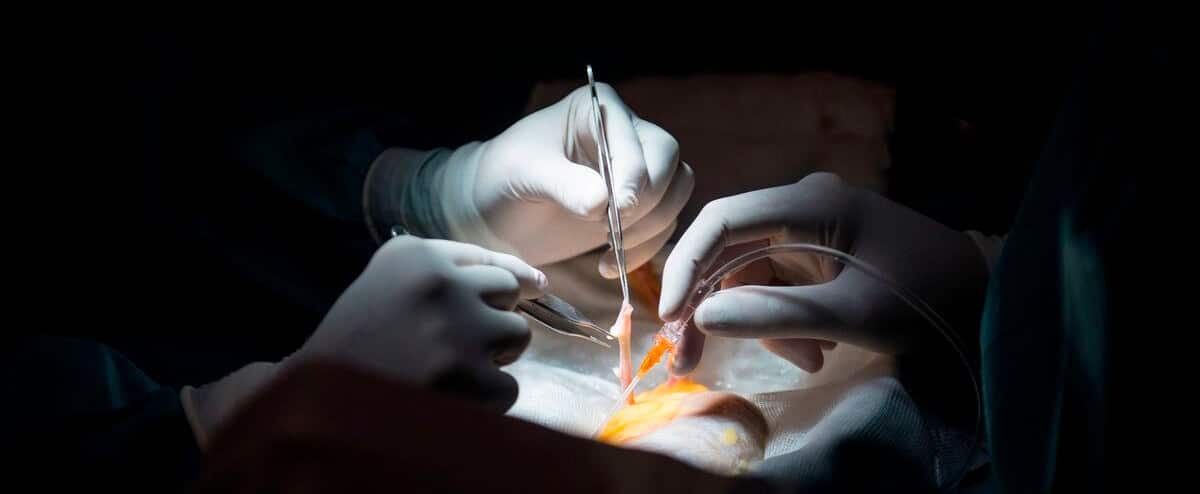 The pandemic has slowed organ donation 1