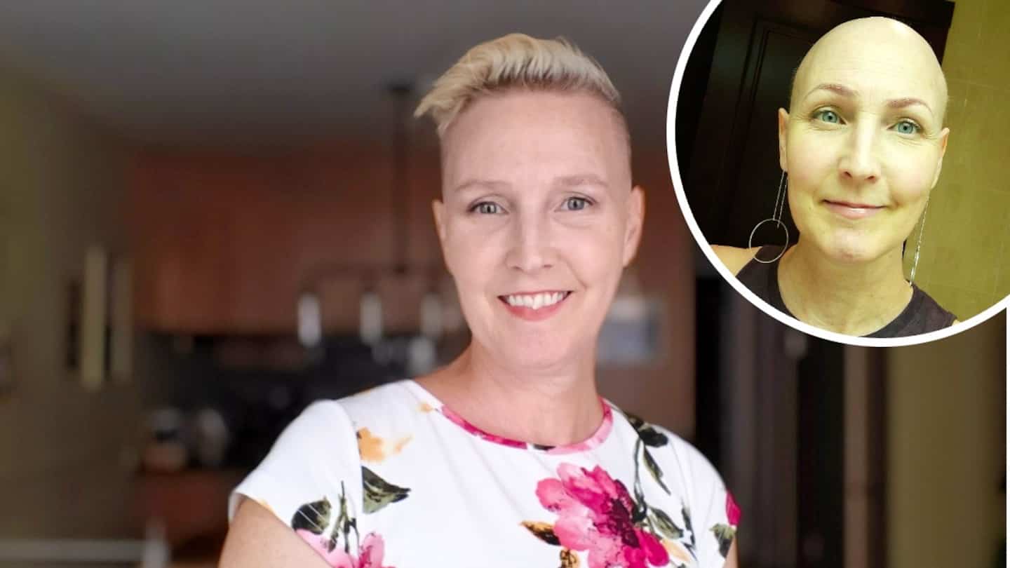 Une Québécoise dénonce l'absence de remboursement pour le traitement de l'alopécie