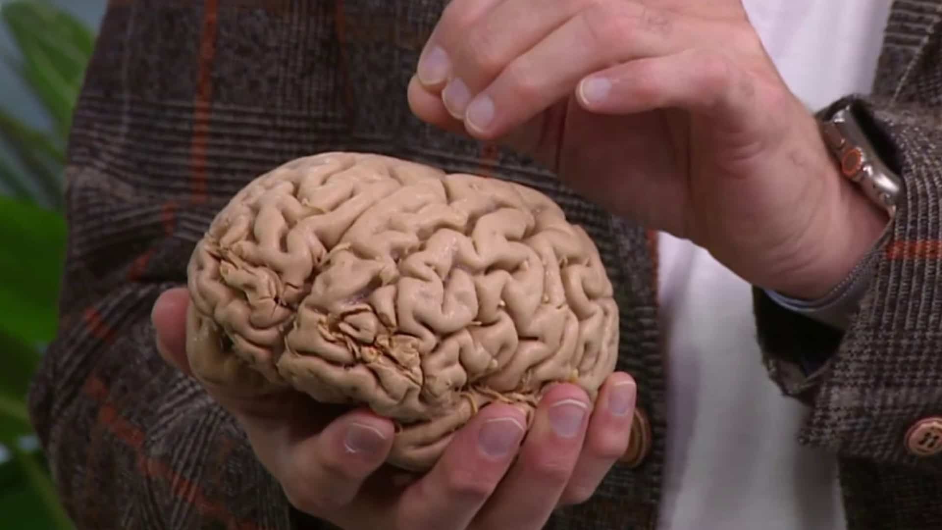 L’incroyable complexité du cerveau humain 