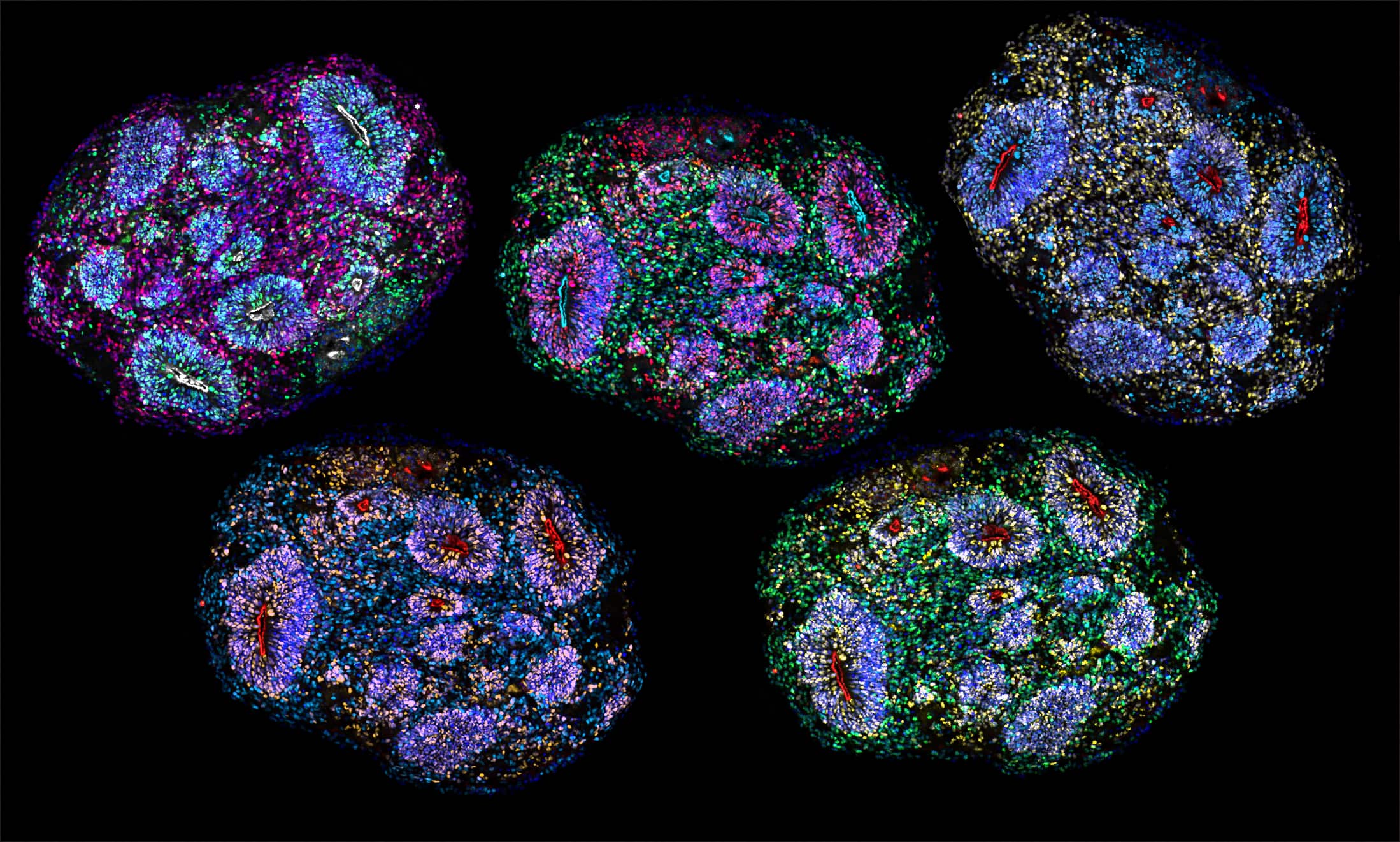 Créés en laboratoires: de minuscules blocs de cerveau étudiés pendant des années