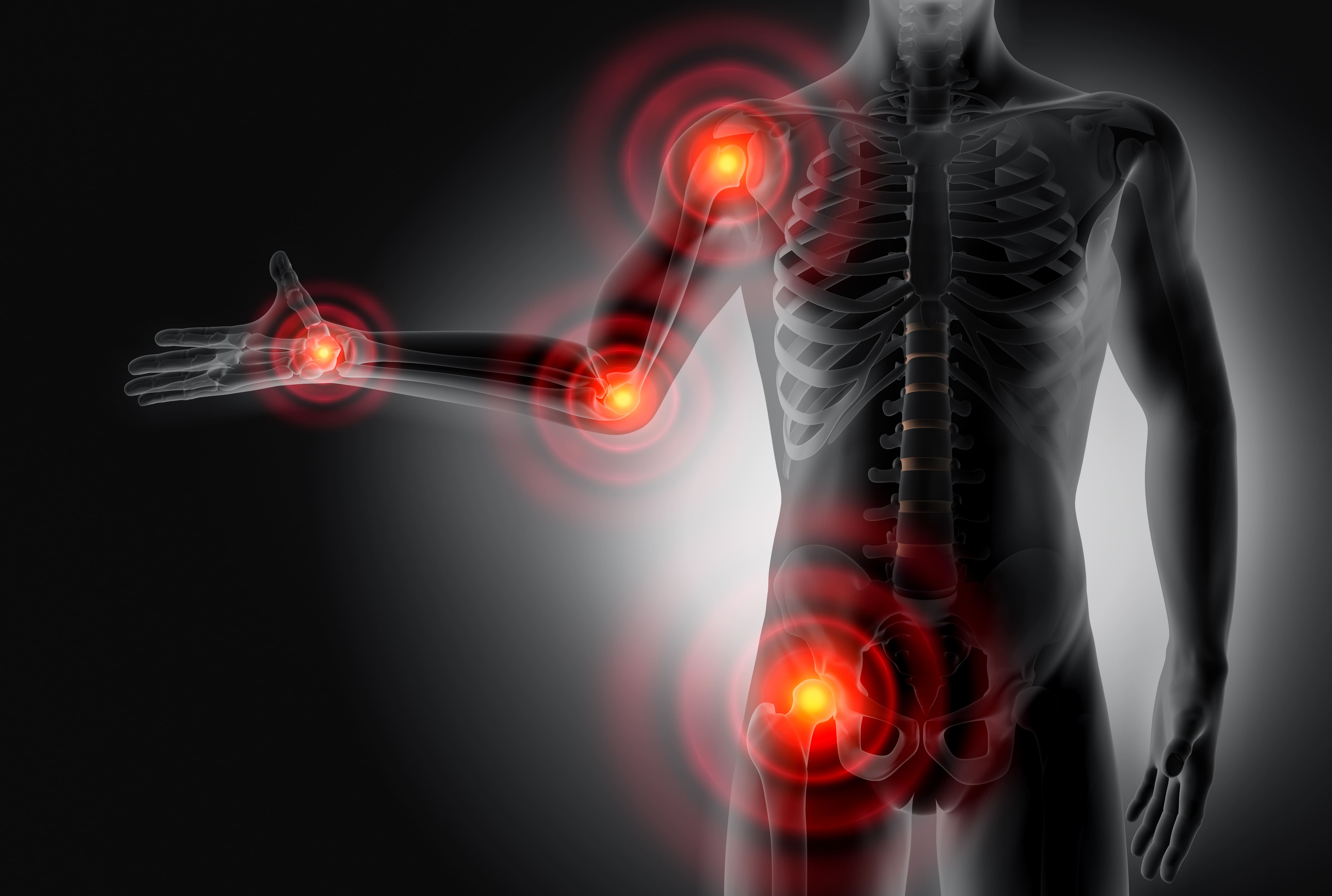 Une nouvelle perc&eacute;e scientifique pour traiter la douleur chronique