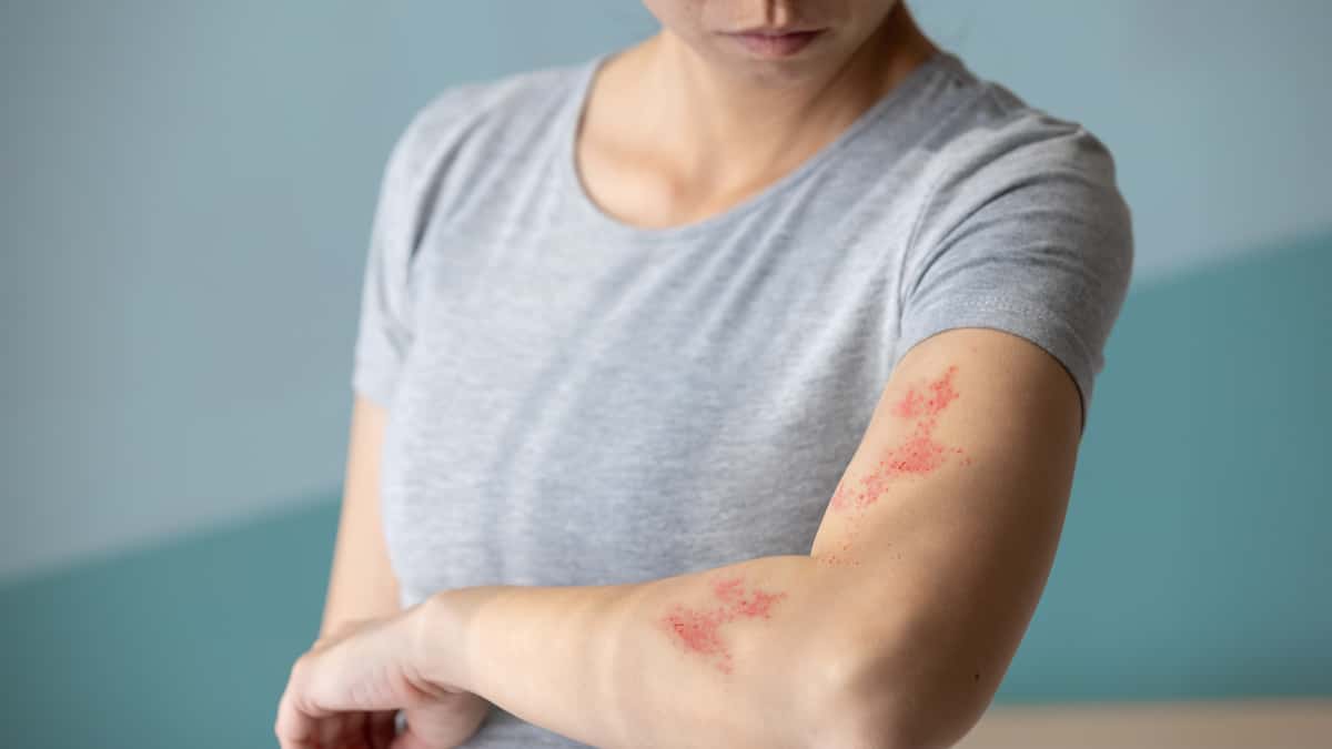 Zona: Québec élargit la vaccination gratuite à partir de demain