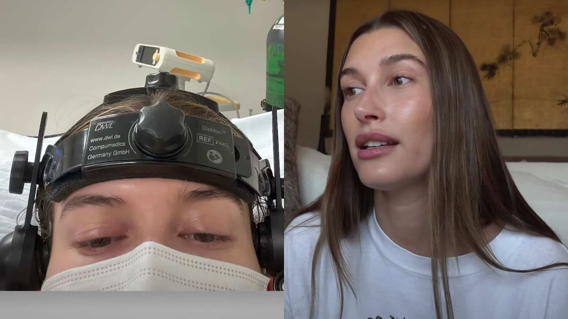 Hailey Bieber victime d'un caillot au cerveau
