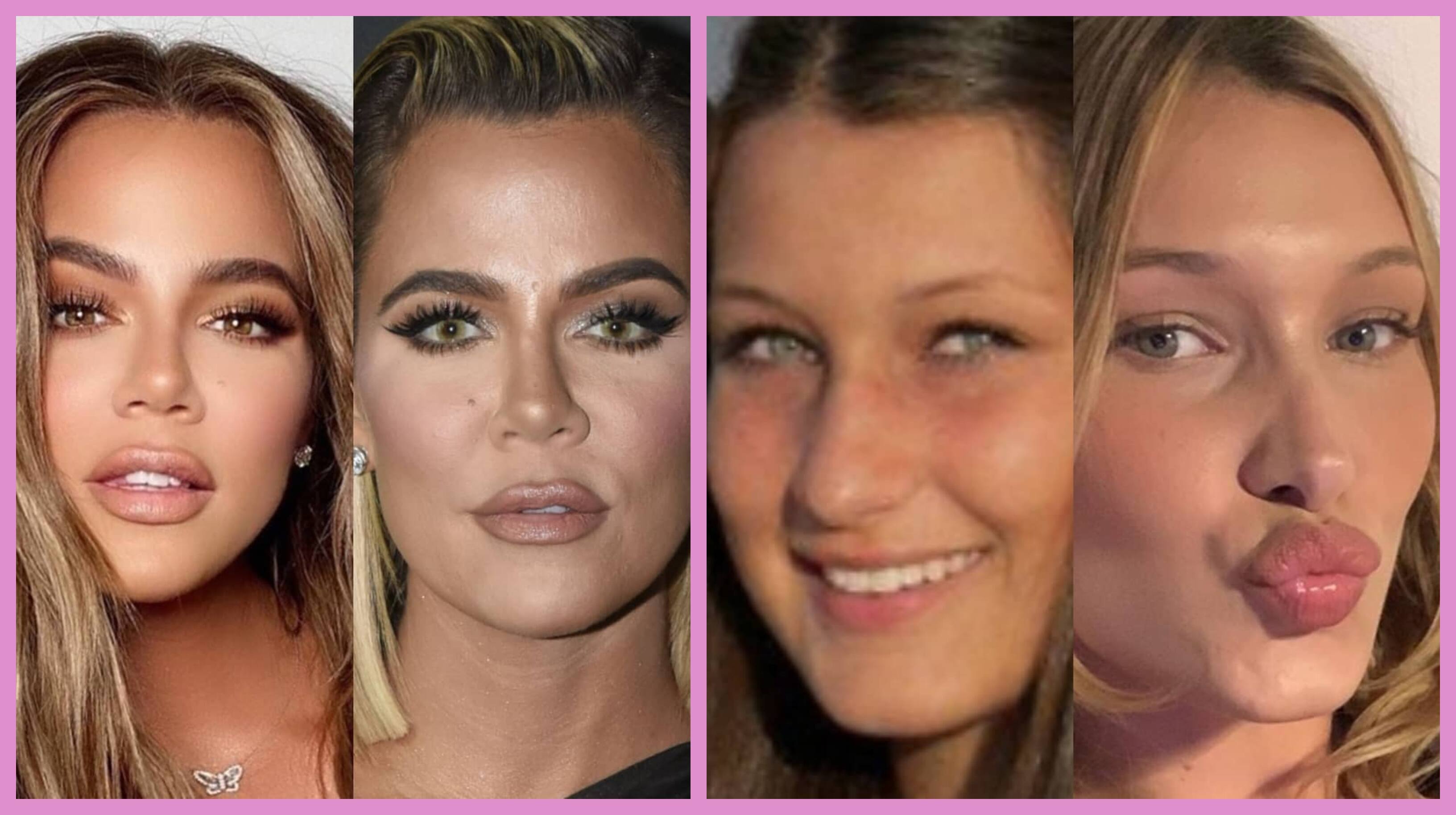 Avant/Après Ces 21 stars sont soupçonnées d’avoir eu recours à la chirurgie plastique Clin d