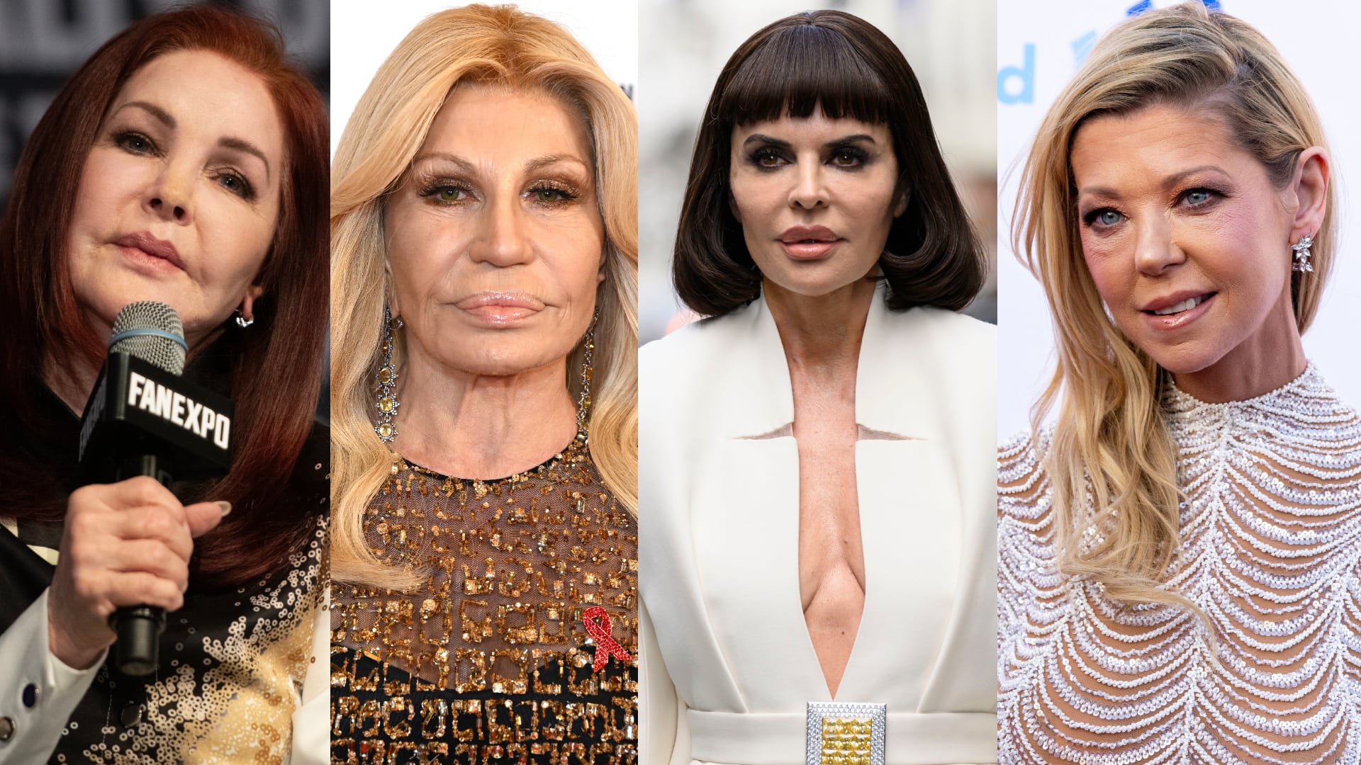 31 célébrités qui ont abusé de la chirurgie 