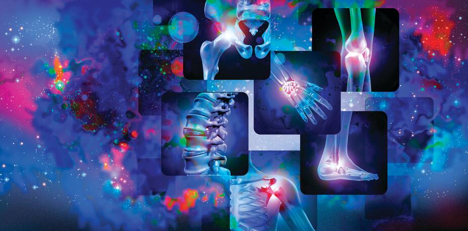 Image principale de l'article L'arthrite: un mal douloureux et très répandu