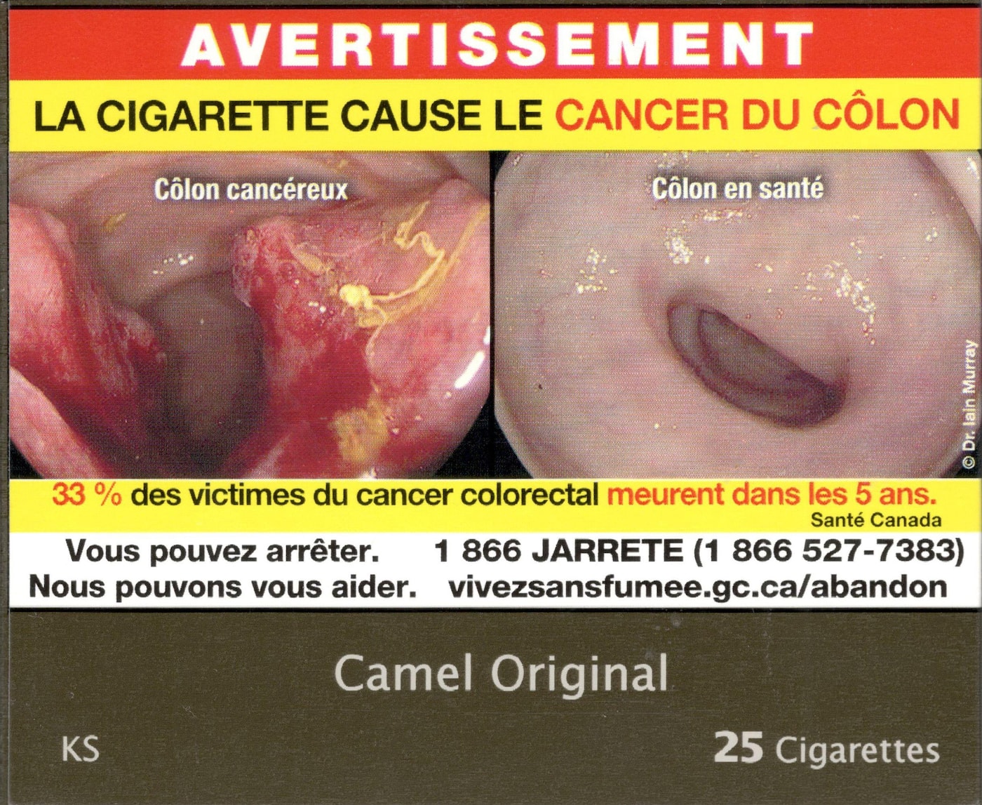 la cigarette cause le cancer Les messages lis la sant de tous les emballages de produits du tabac : Avertissements sanitaires sur les emballages Le tabac une substance mortelle