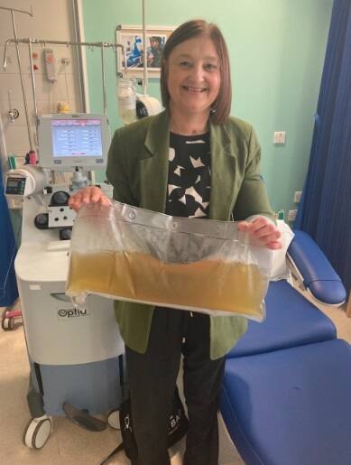 Greffe des deux mains: premi&egrave;re transplantation r&eacute;ussie gr&acirc;ce &agrave; un nouveau traitement contre les rejets