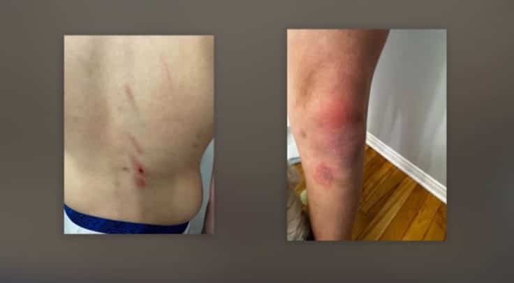 Battu avec une brique: un élève de 12 ans aurait été violemment agressé par des ados près d’une école de Gatineau