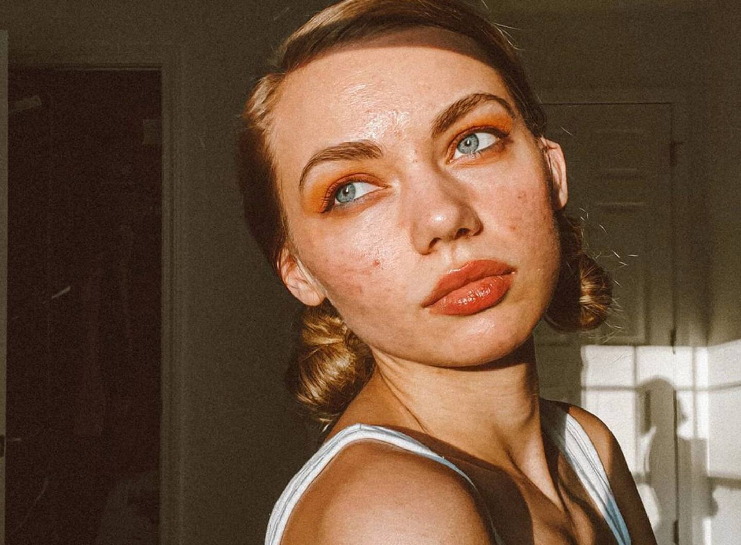 10 soins testés pour combattre l’acné