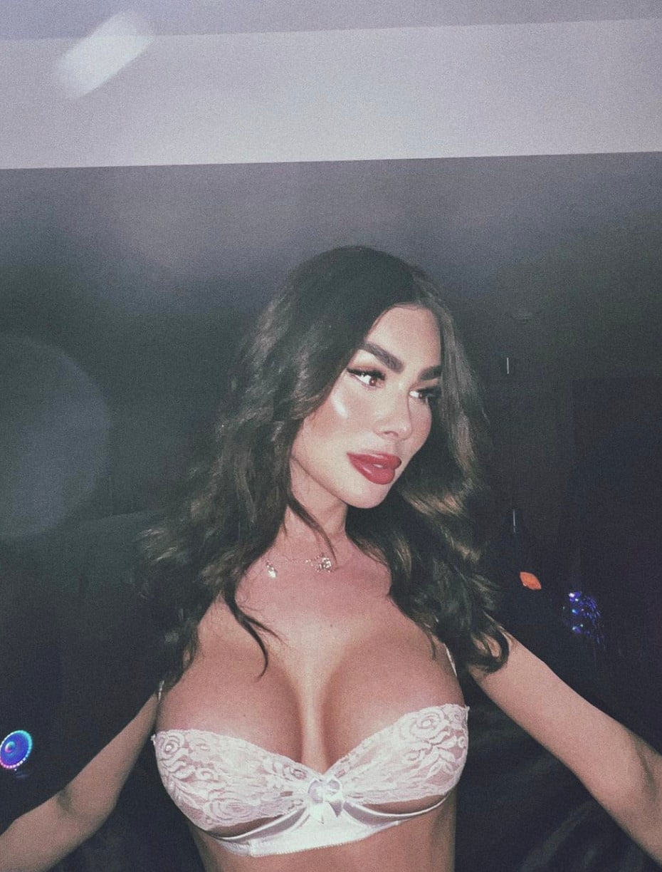 10 influenceuses qui ont des injections aux lèvres