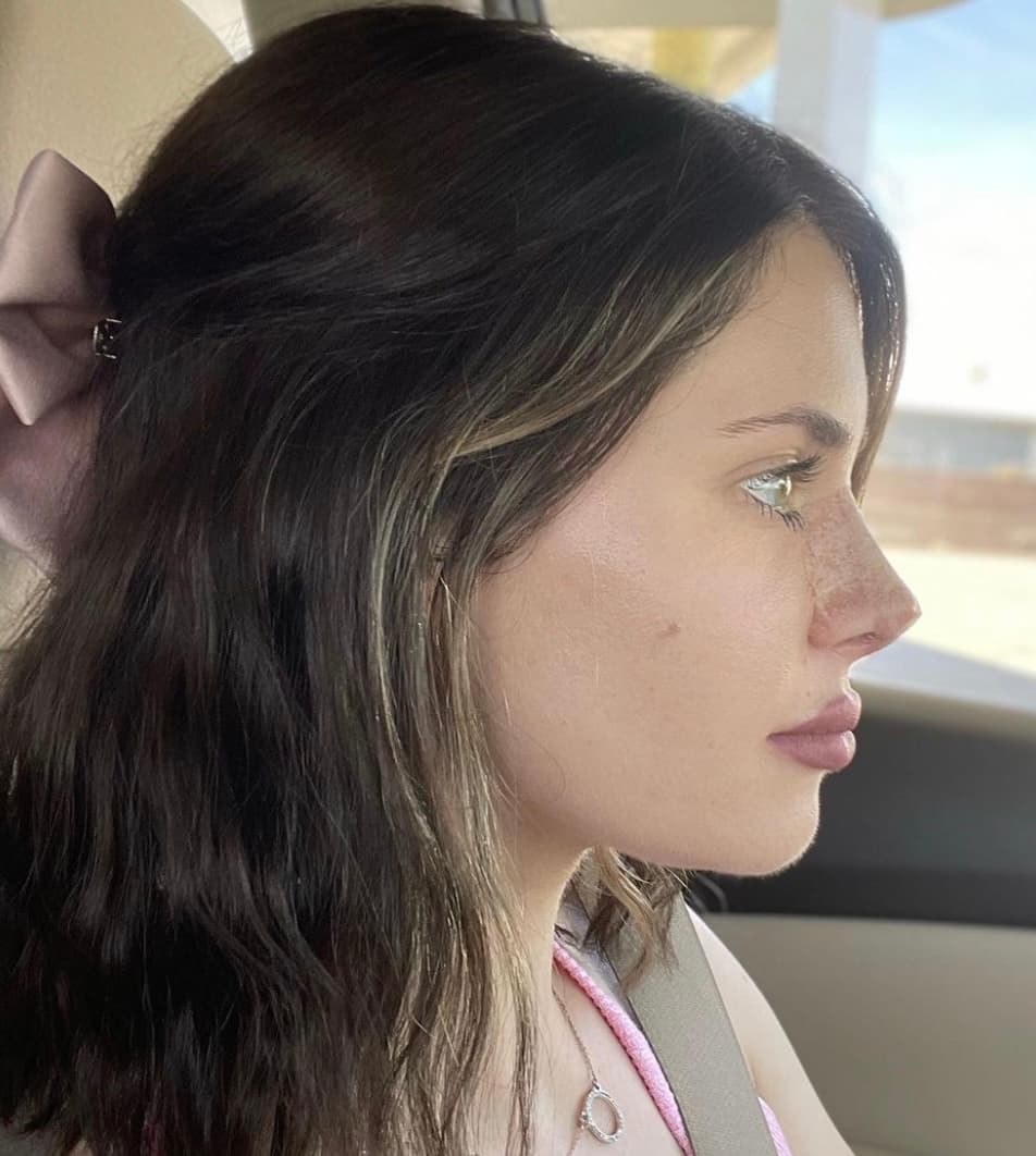 «Tape» sur le nez: la fausse bonne idée sur TikTok