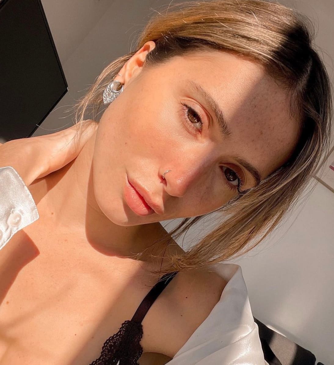 Lysandre adopte ces populaires patchs anti-boutons