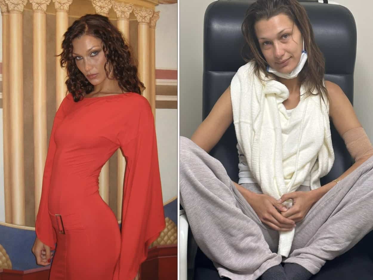 Bella Hadid s'ouvre sur la maladie de Lyme