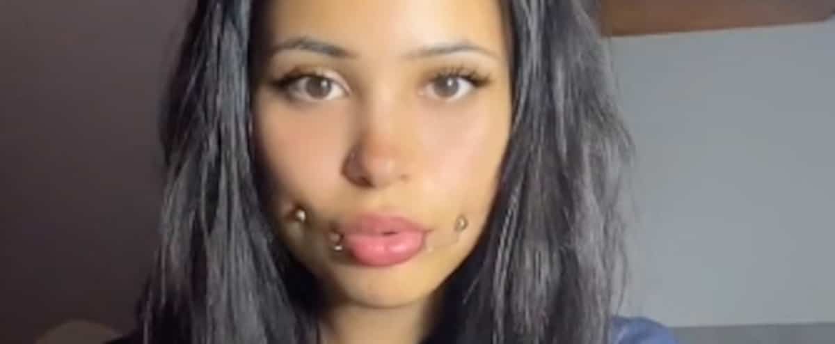Angry Dimple Dangerous Dimple-Making Tricks: Experts Warn of Long-Term Damage – Archyde