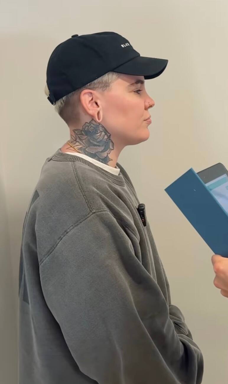 Sous le bistouri pour ses lobes d'oreilles