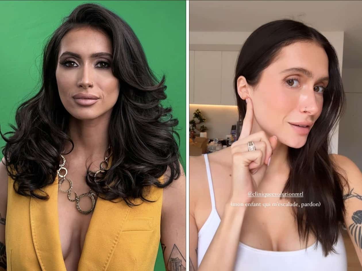 Elle se fait proposer de la chirurgie esthétique