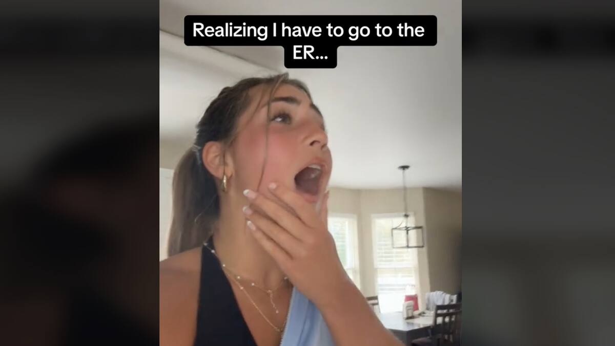 “Something like that could only happen to me”: she yawns so hard that her jaw jams “Something like that could only happen to me”: she yawns so hard that her jaw jams