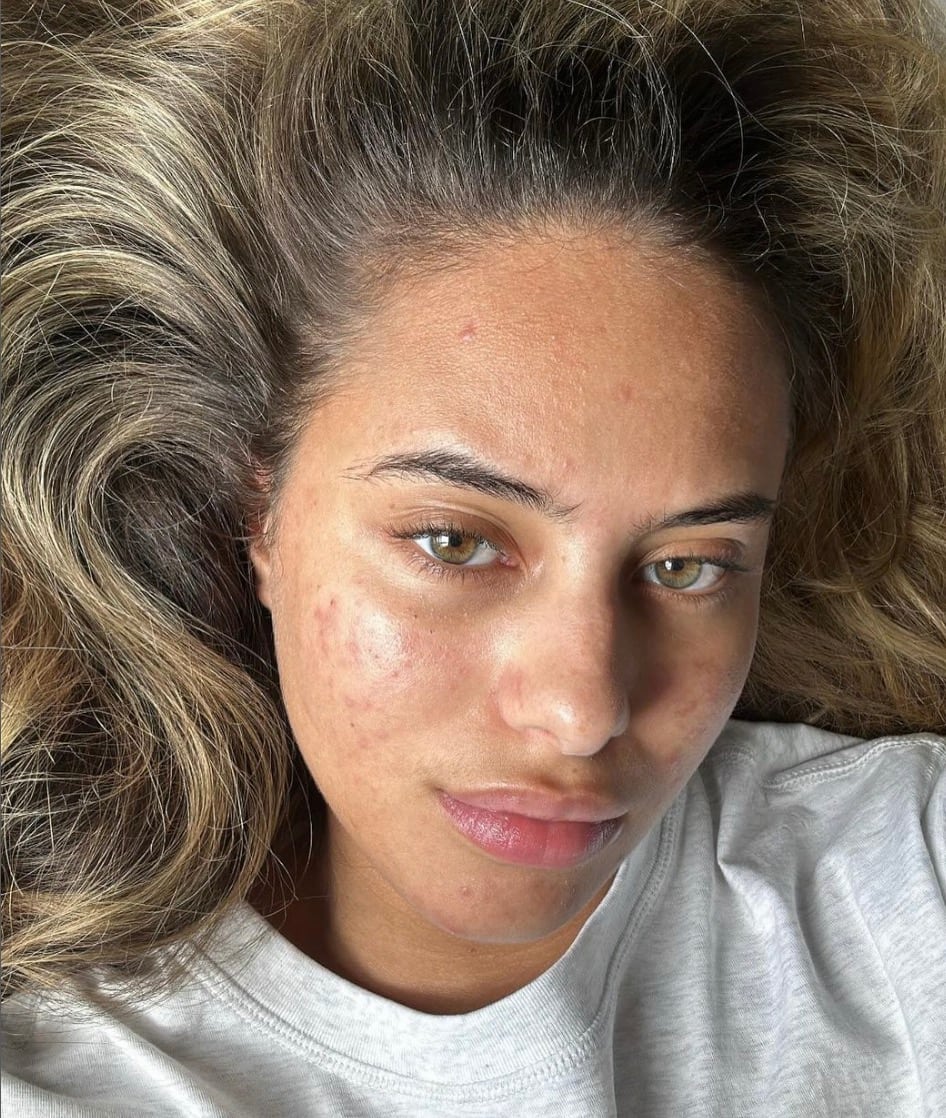 Les dermatologues sonnent l'alarme 