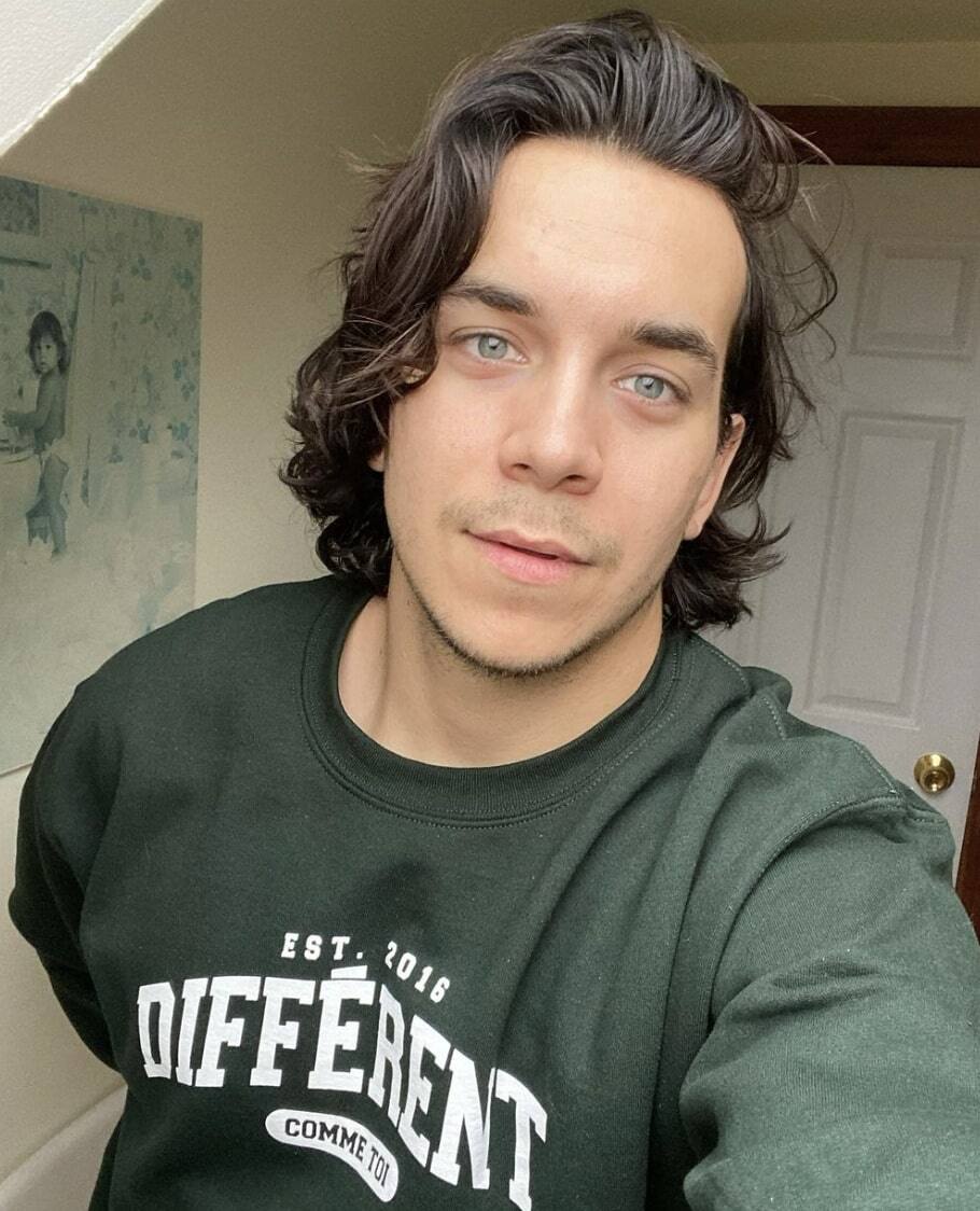 Il s’ouvre sur son sévère problème d'acné