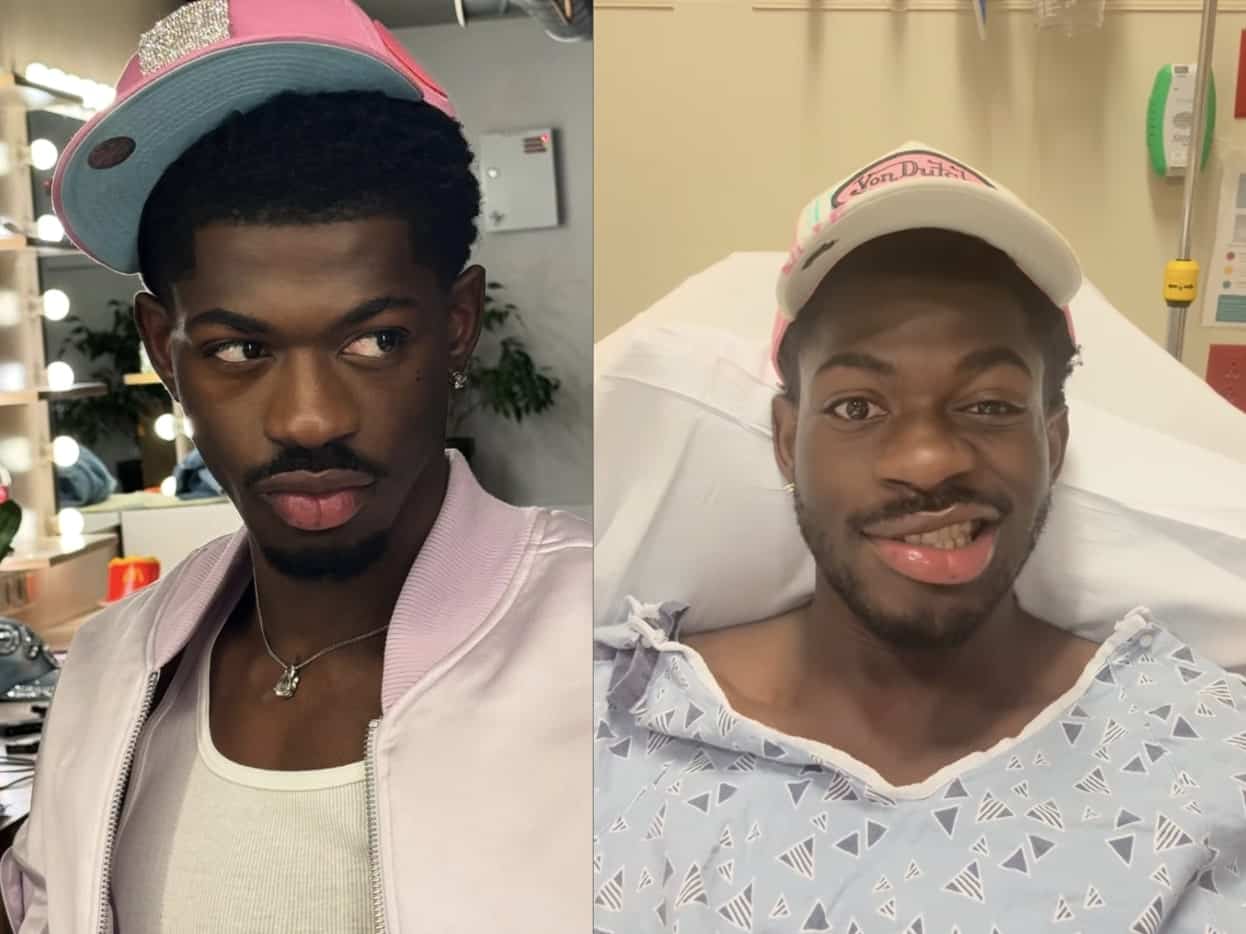 Partiellement paralysé comme Justin Bieber