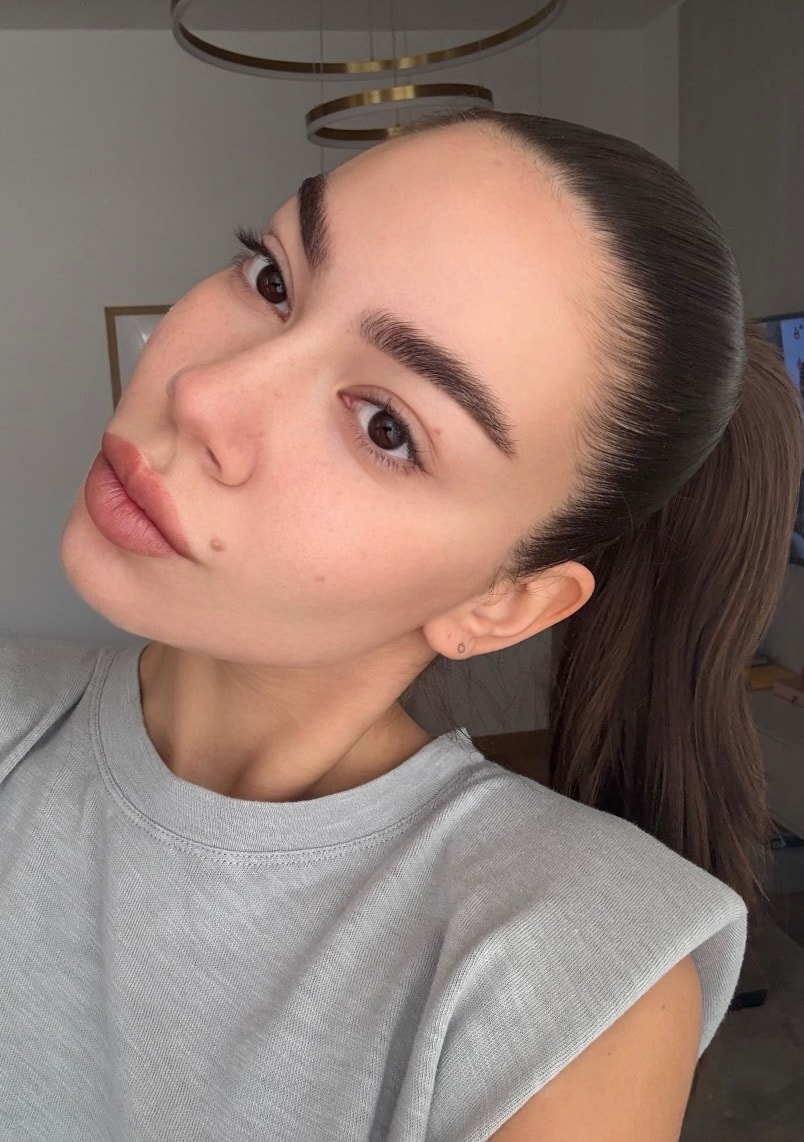 Cette technique lifte le visage sans chirurgie