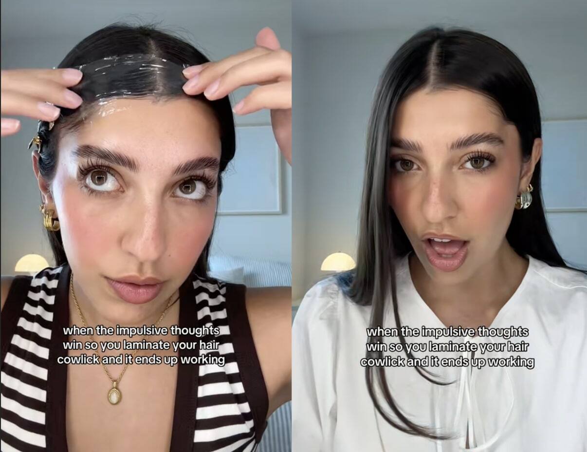 LA solution pour dompter la rosette selon TikTok