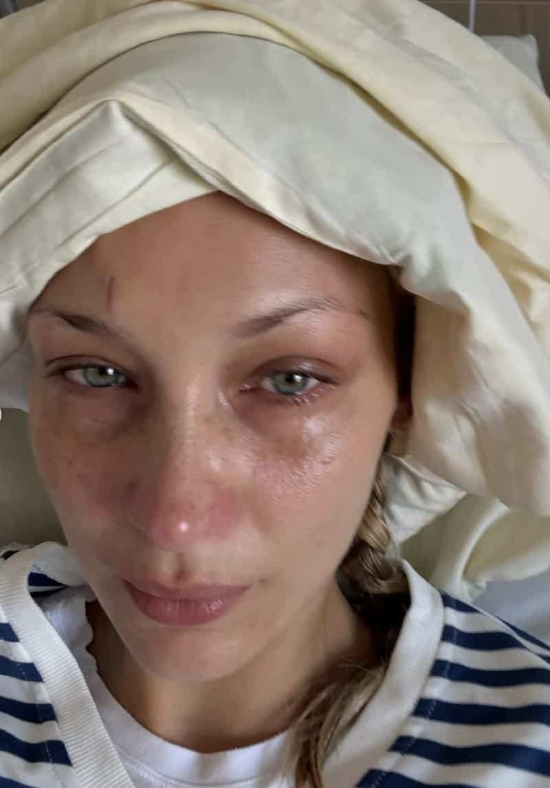 Elle partage des photos depuis son lit d'hôpital