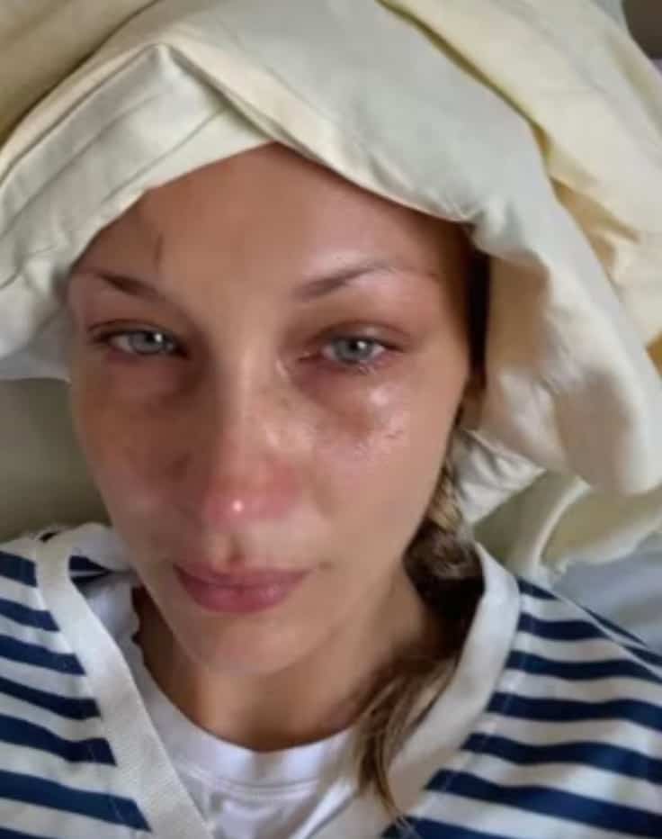Bella Hadid publie des photos d’elle à l’hôpital
