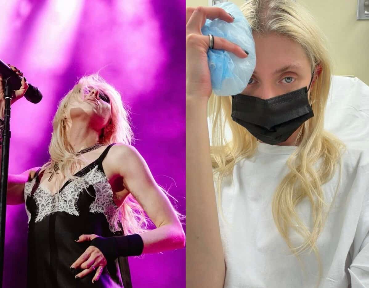 Image principale de l'article Hospitalisée pour une morsure d'araignée venimeuse