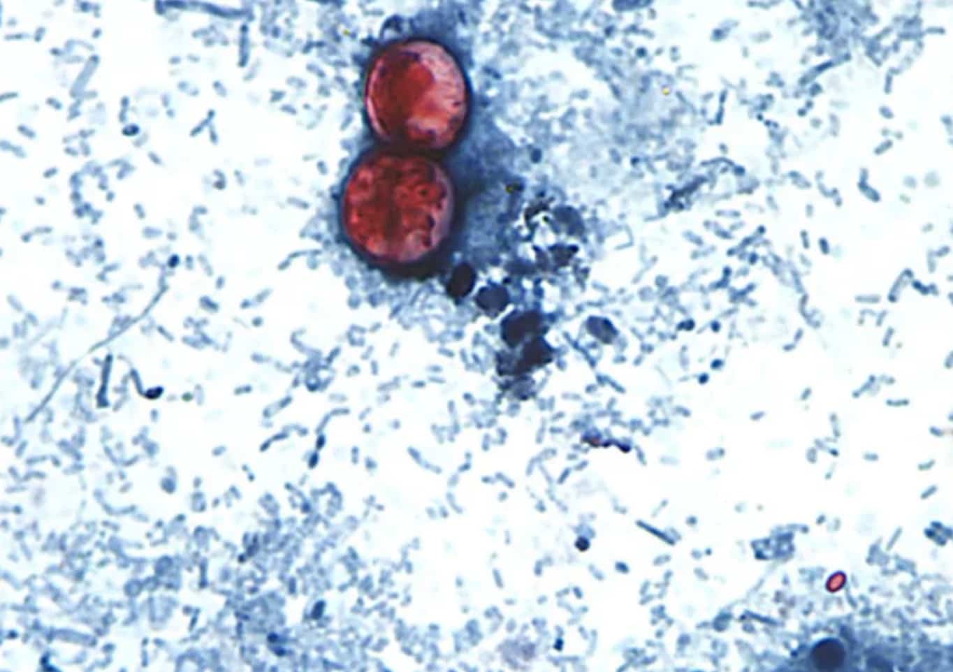 le Cyclospora