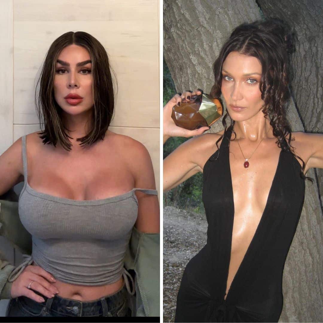 9 vedettes qui ont regretté leur chirurgie 