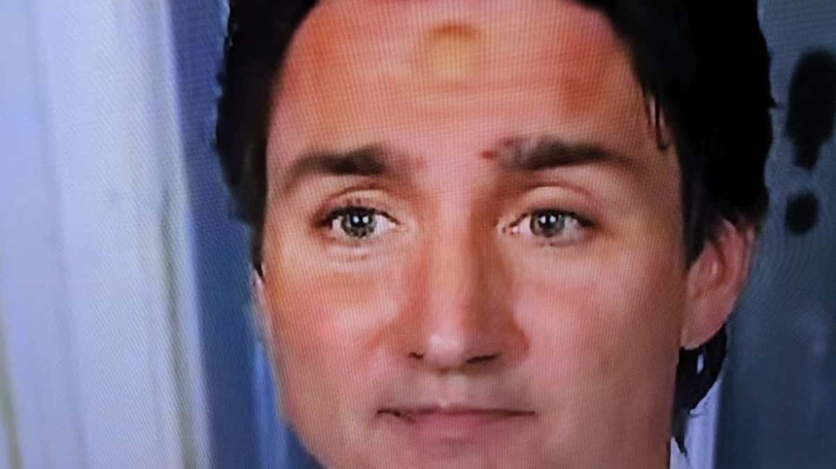 Sign Target Forhead Trudeau Qu’est-ce qui est arrivé au front de Justin Trudeau? | TVA Nouvelles