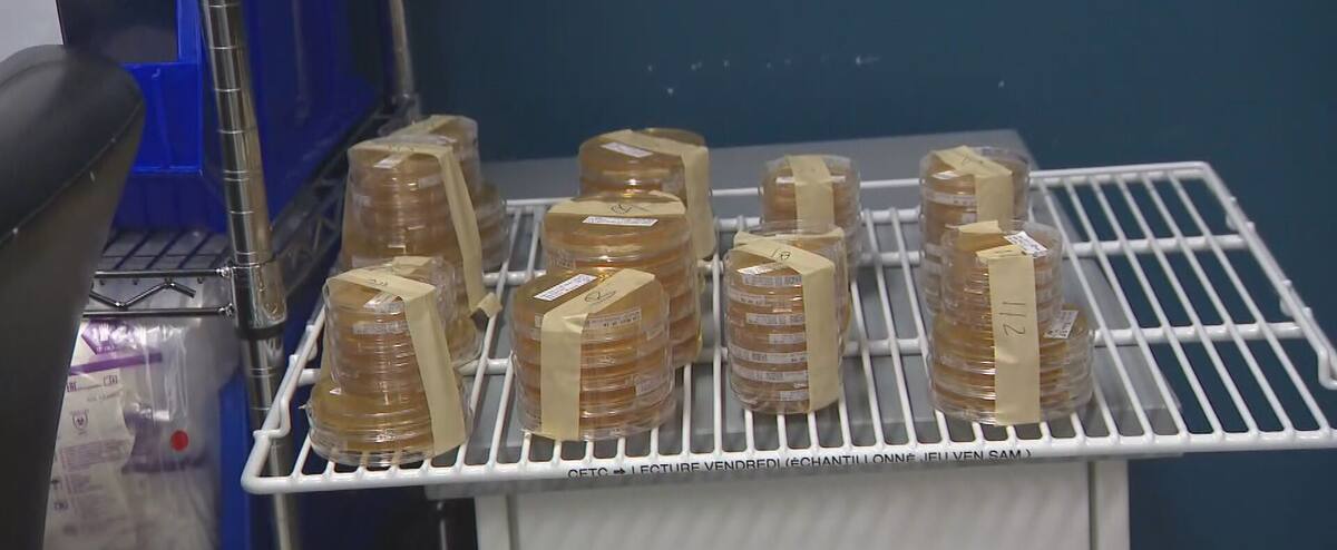 Des chercheurs montréalais font une avancée extraordinaire en thérapie cellulaire