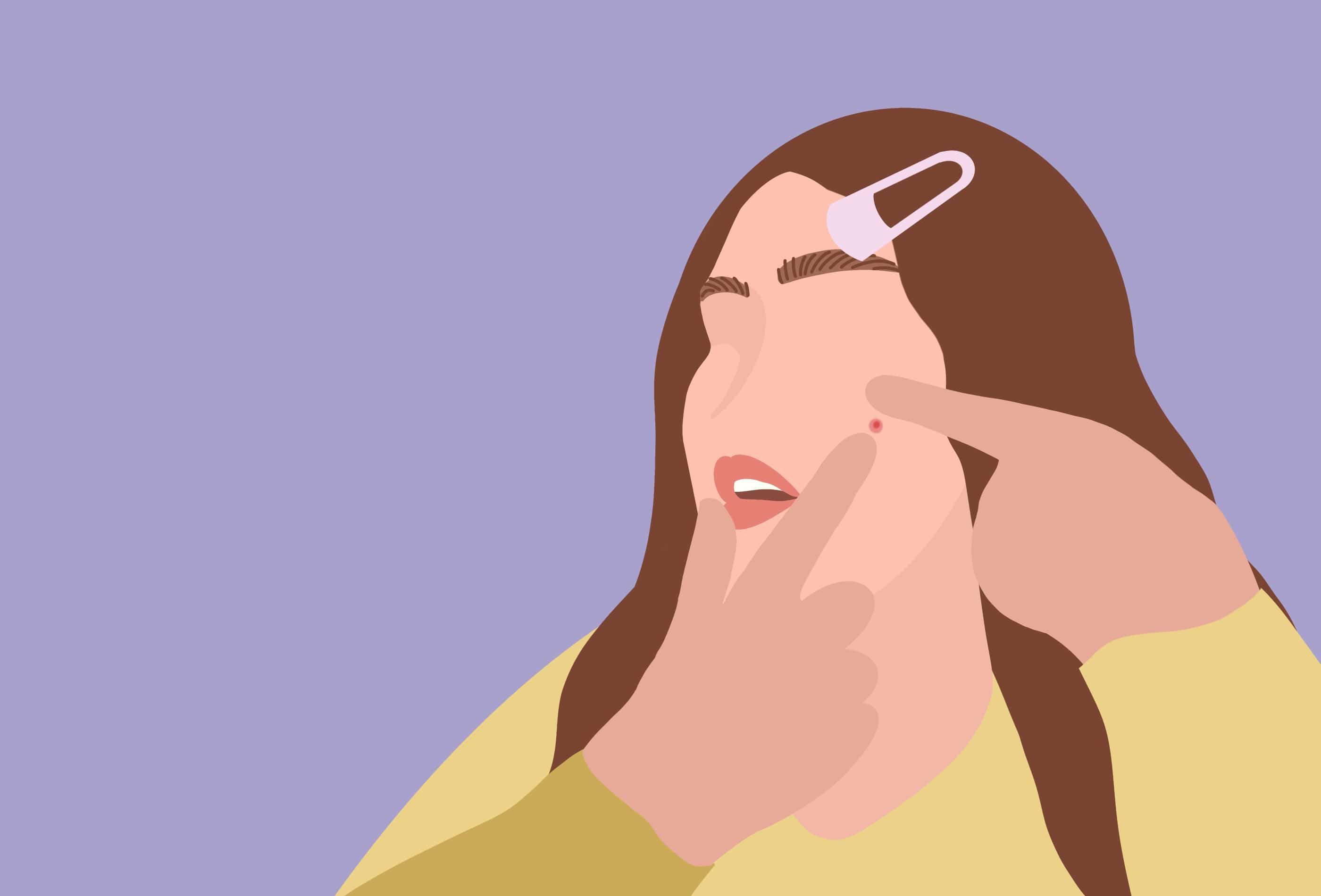 Acné : les types de boutons et comment les traiter