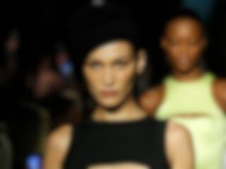 Tout sur les différents types de cernes et poches