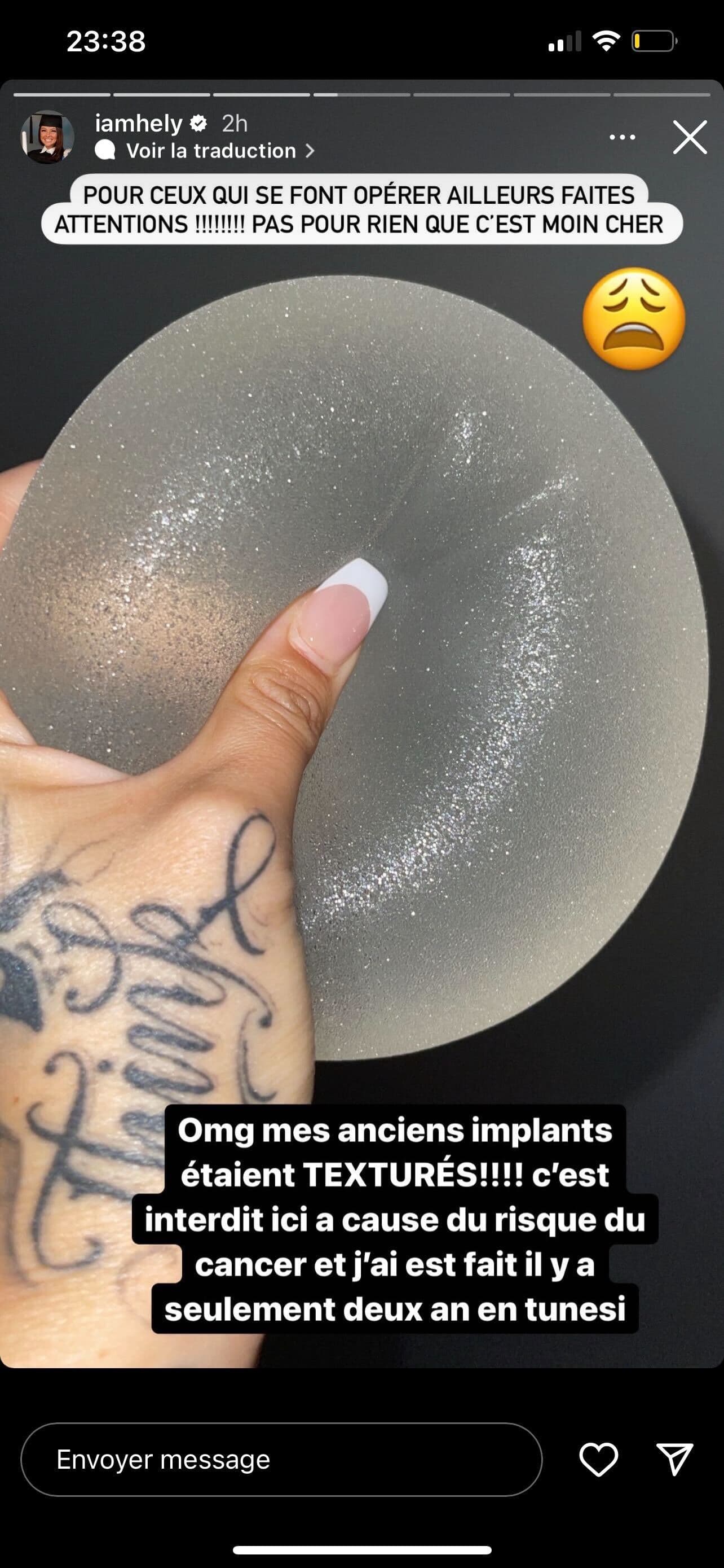Kim K Retire Ses Implants