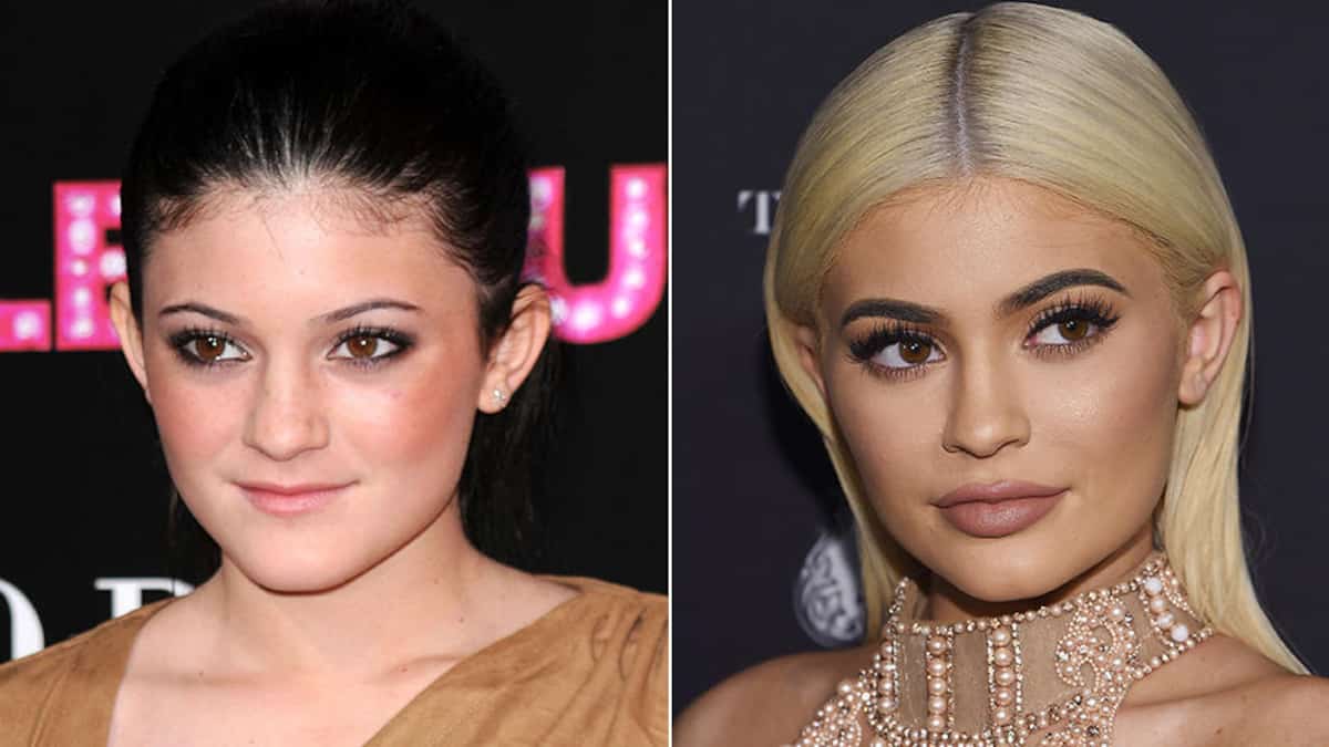 Kylie Jenner Brust Op Kylie Jenner Brust Op