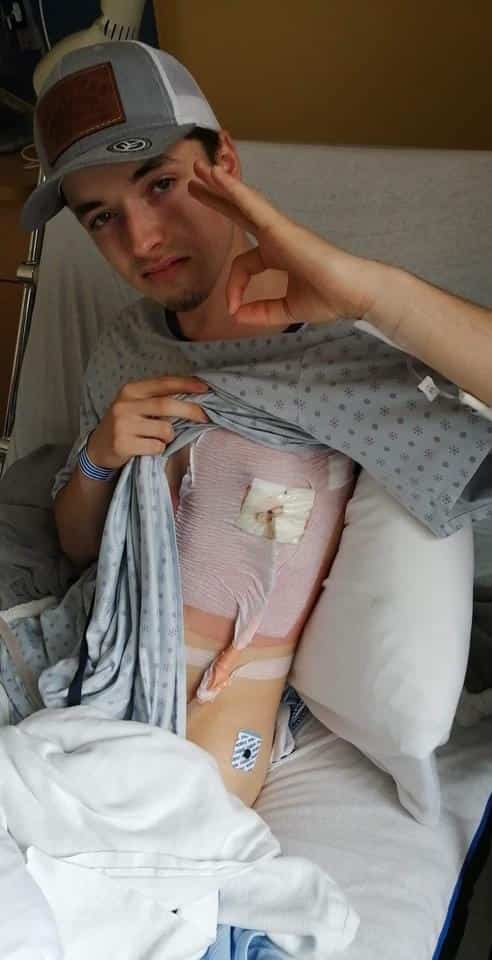 À l'hôpital à cause de sa vapoteuse? Un Québécois de 20 ans raconte son  histoire sur TikTok