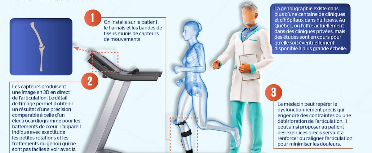 La genougraphie à la rescousse