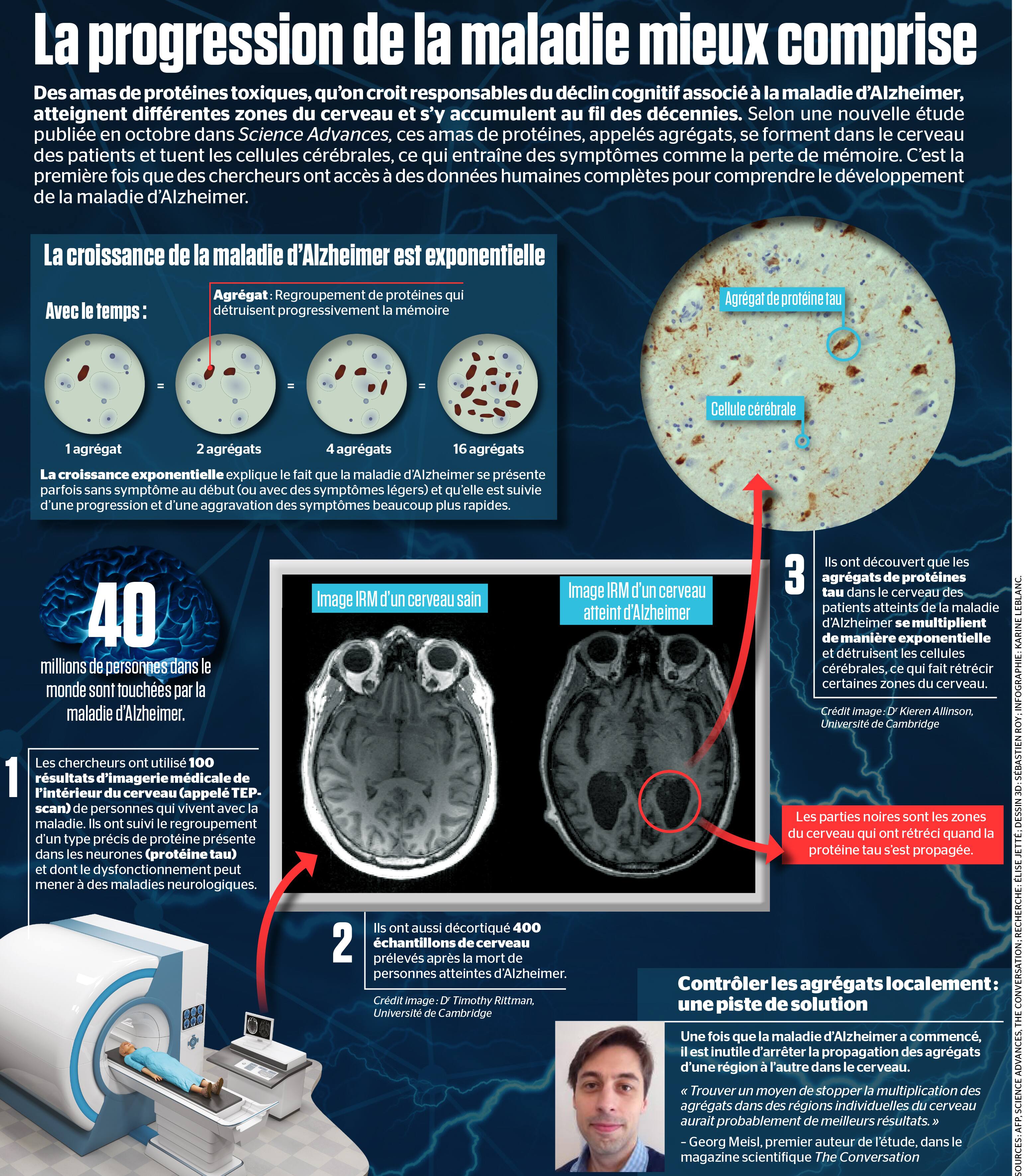 La progression de la maladie mieux comprise
