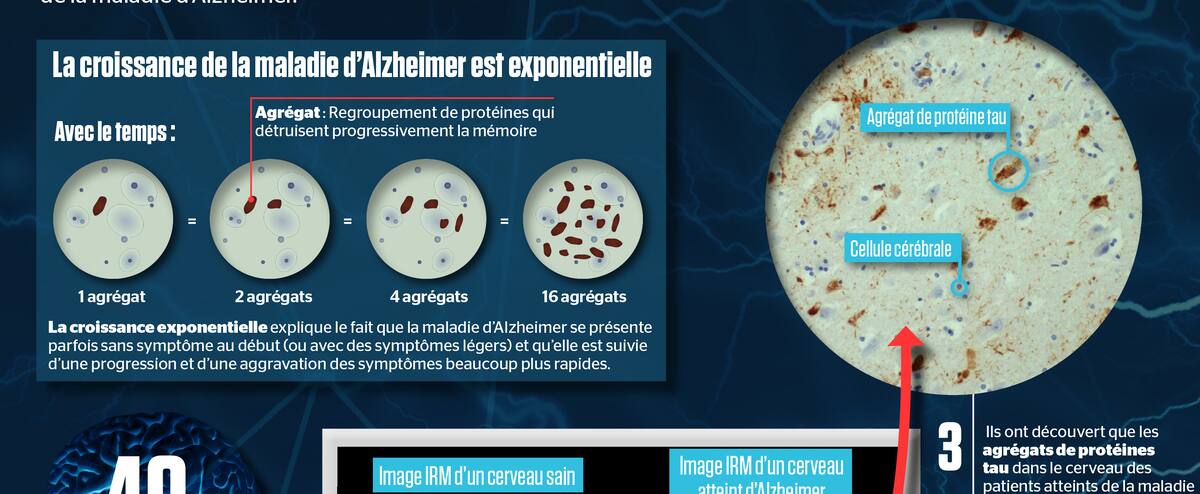 La progression de la maladie mieux comprise