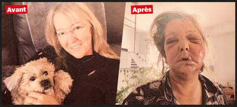 Sylvie Lachapelle before and following the assault.