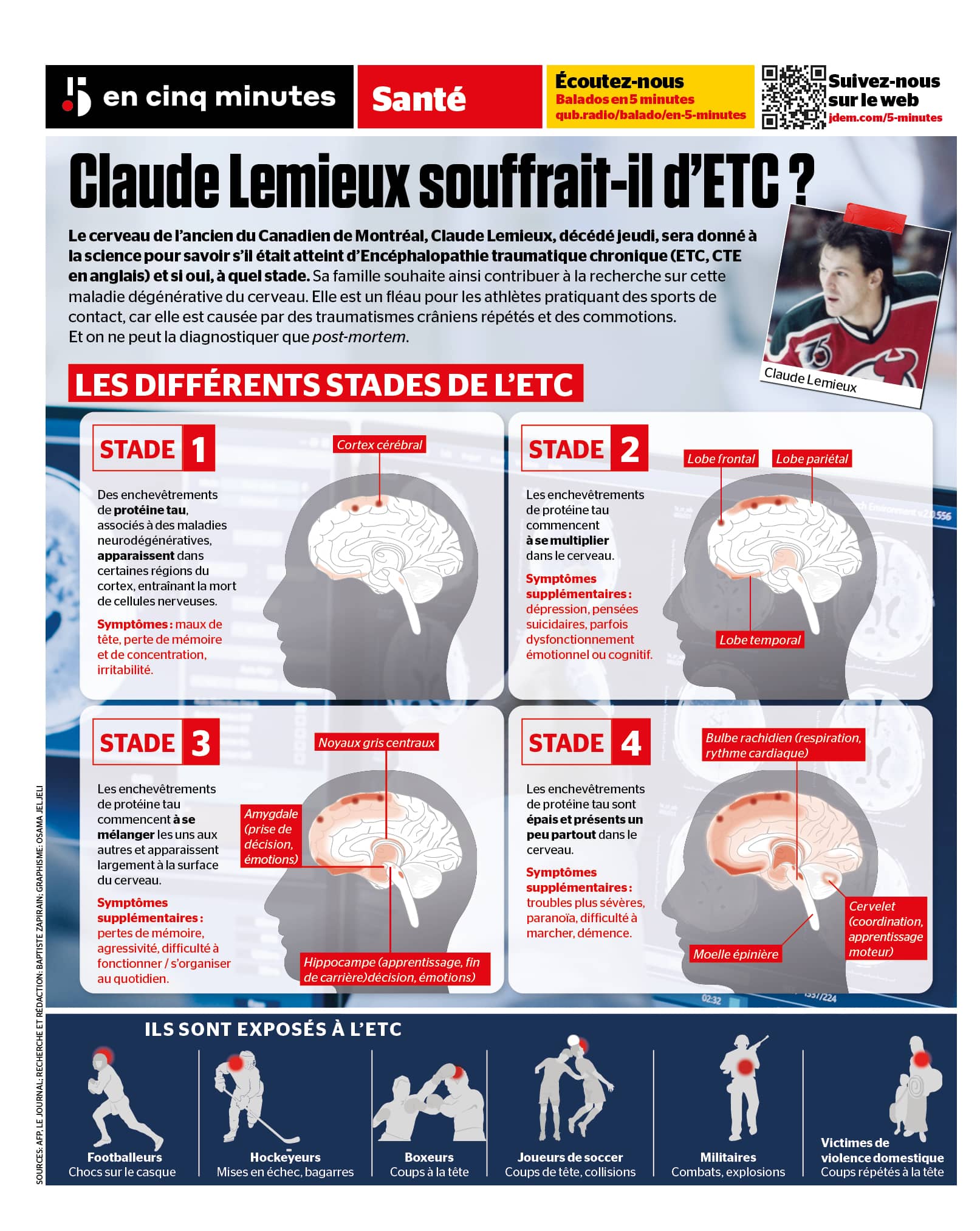 INFOGRAPHIE | Claude Lemieux souffrait-il d'ETC?